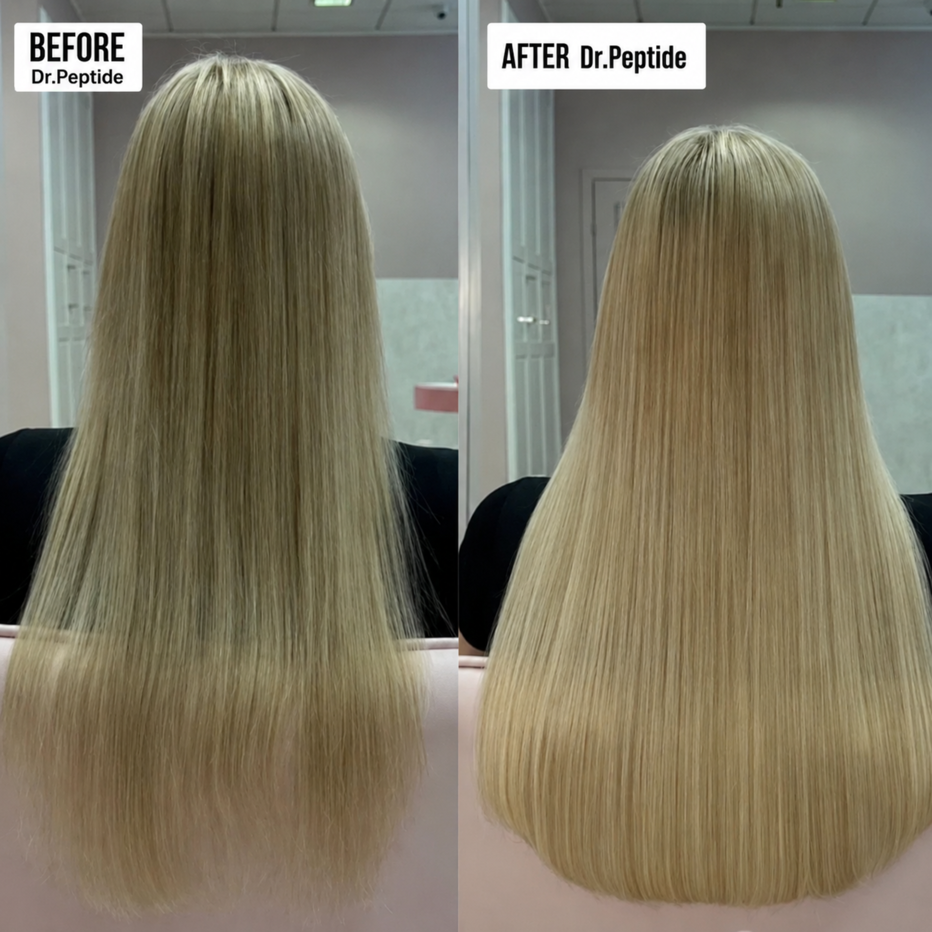 The Most Powerful Peptide Infusion  Hair Regrowth System