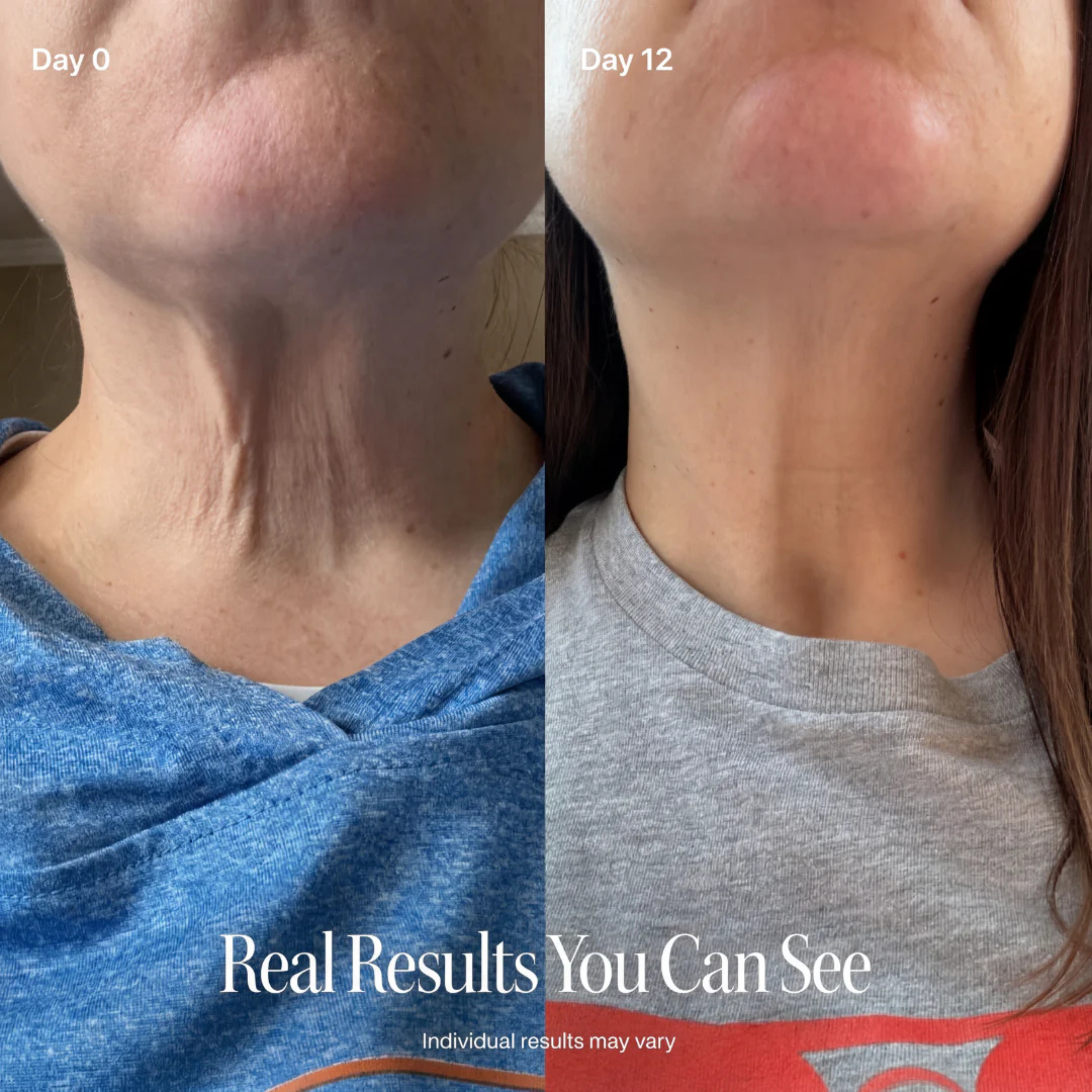 Dr.peptide Neck Firming Cream
